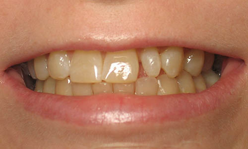 دهان و دندان بیانگر وضعیت سلامت بدن/ تشخیص بیماری ها از روی دهان و دندان ها ممکن است