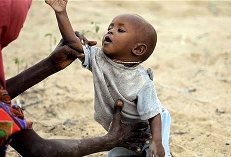 فائو: سالانه بیش از سه میلیون کودک بر اثر سو تغذیه می‌میرند