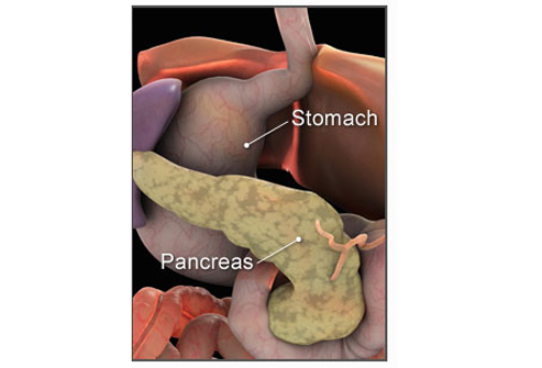 التهاب پانکراس به سایر ارگان های حیاتی بدن نیز آسیب وارد می کند