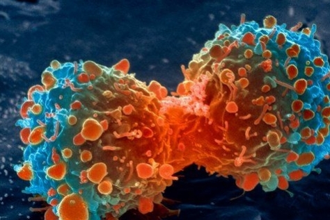تنظیم انرژی سلول های سرطانی برای بقا
