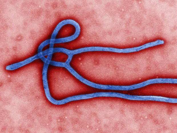 حقایقی در مورد ویروس ابولا/ آشنایی با علایم، درمان و پیشگیری از ابولا
