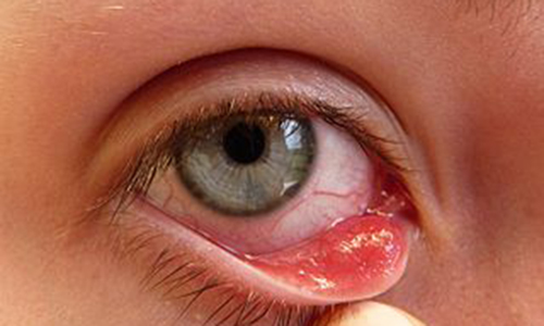 چشمان ما بیانگر وضعیت سلامتی ما هستند/ آشنایی با علایم برخی بیماری ها از طریق چشم ها