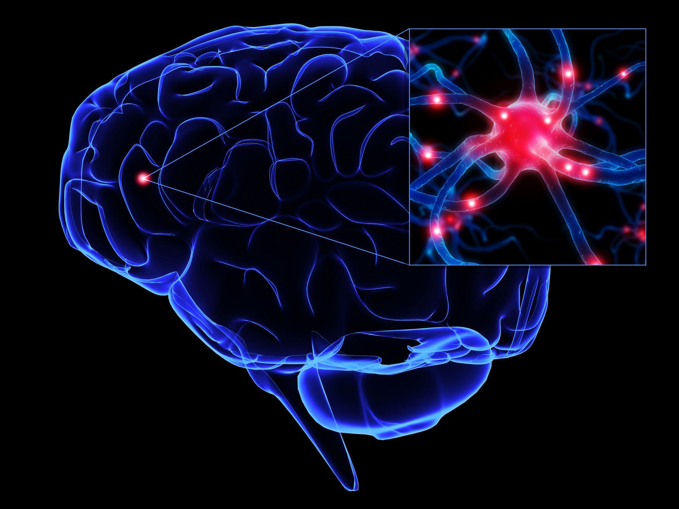 کلیدی ترین نکات و پاسخ به پرسشهای رایج در مورد «سکته مغزی»/ در مورد سکته مغزی چه میزان اطلاعات دارید؟
