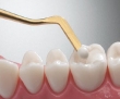 تولید نانوکامپوزیت‌های دندان نژاد ایرانی در کشور/جلوگیری از خروج ۸ میلیون دلاری ارز