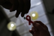 اولین درمان یک زن مبتلا به ایدز بوسیله پیوند سلول‌های بنیادی