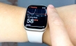 اپل یک قدم دیگر به افزودن سنسور اندازه‌گیری فشار خون به اپل واچ نزدیک‌تر شد