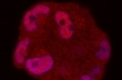 شناسایی یک راهبرد جدید مولکولی برای درمان سرطان پروستات