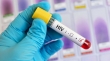 درمان موفق HIV در آستانه آزمایشات انسانی