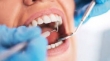 پیشگیری از بیماری های دندانی، اصلی فراموش شده!