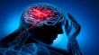 پیشگیری از سکته مغزی با فناوری جدید