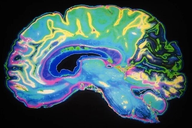 پژوهشگران به درک عمیق‌تری درباره پیچیدگی مغز انسان رسیدند