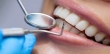 تعرفه جدید دندانپزشکی 1401 اعلام شد + جزئیات