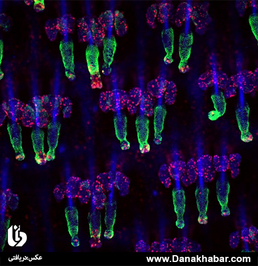 رتبه هشتم: یارون فوشس، دانشگاه راکفلر نیویورک آمریکا
سلول‌های بنیادی فولیکول مو دم موش با استفاده از نشانگر K15 (رنگ سبز) علامت‌گذاری شده است، و نشانگر Ki67 (رنگ قرمز) نیز سلول‌های تکثیر شده را نشان می‌دهد. هسته سلول‌ها با استفاده از نشانگر DAPI (رنگ آبی) نشان‌گذاری شده است.
تکنیک: عکاسی هم‌کانونی