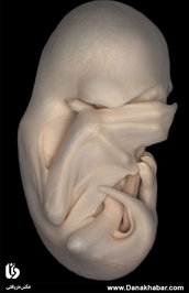 رتبه دوم: دریت هاکمن، دانشگاه آکسفورد انگلستان
این نمای جانبی از رویان خفاش بولداگ سیاه، جنین را در مرحله «قایم با شک» نشان می‌دهد؛ مرحله‌ای از رشد جنین که در آن بال‌ها رشد یافته‌اند و روی چشمان جنین را پوشانده‌اند. هم‌زمان که رشد جنین ادامه می‌یابد، انگشتان بلندتر شده و تیرک‌های مانورپذیر بال‌های آن را شکل می‌دهند.
تکنیک: استریو میکروسکوپی