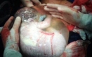 تصویری نادر از تولد یک نوزاد درون کیسه آب