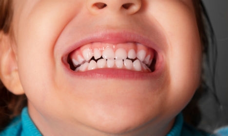 آشنایی کامل هیجان انگیزترین دوران رشد کودک دلبند شما/ مراحل رشد دندان کودک