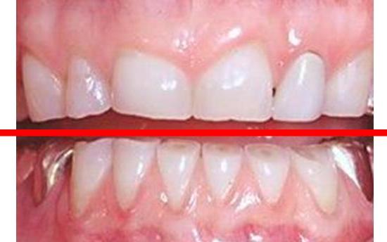 دهان و دندان بیانگر وضعیت سلامت بدن/ تشخیص بیماری ها از روی دهان و دندان ها ممکن است