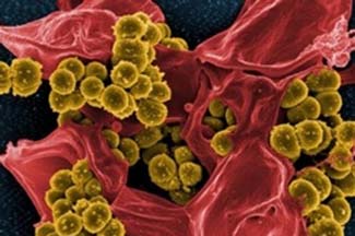 خسارت‌ مقاومت آنتی‌بیوتیک: 300,000,000 نفر کشته و 100,000,000,000,000 دلار هزینه