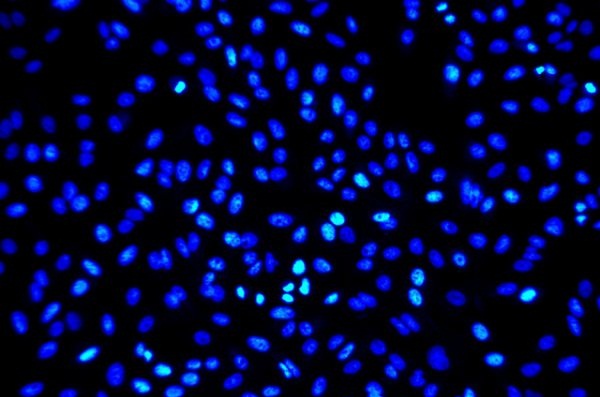 کشف پروتئین موثر در کشتن سلول‌های سرطانی
