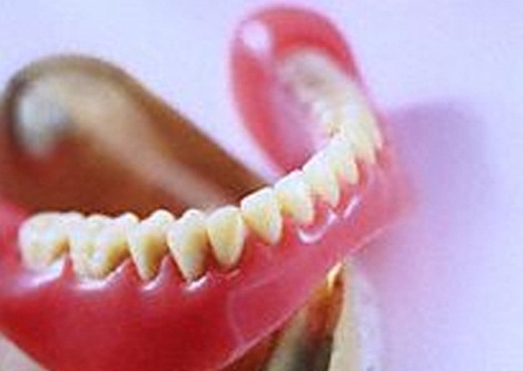 با دندان مصنوعی نخوابید؛ خطر ابتلا به ذات‌الریه را افزایش می‌دهد