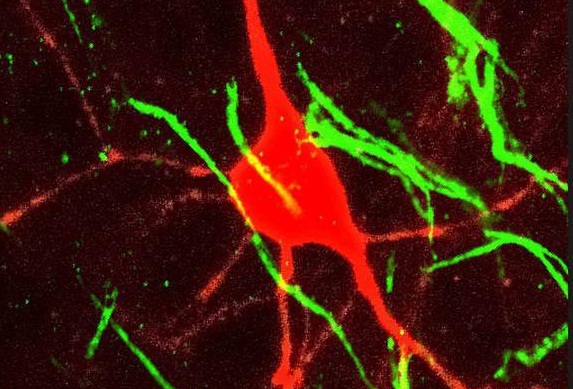 کشف نوع جدید سلول مغزی