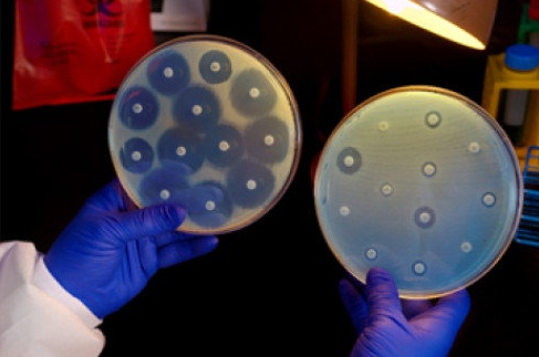 راز عملکرد پنی سیلین در نابودی باکتری ها چیست؟