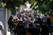 5 تا ۶ میلیون ایرانی اصلا دندان ندارند
