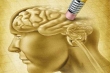 بیماری ژنتیکی جدیدی که احتمالا در آلزایمر و پارکینسون نقش دارد