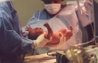 جزئیات روش درمانی اختلالات رحم/شایع ترین علامت اختلال