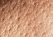 محو کردن منافذ پوست با روشی ساده/ با این ادویه آشپزخانه جان تازه به صورتتان ببخشید