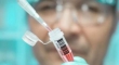 واکسن ایدز سال 2017 وارد مرحله دوم آزمایش های بالینی می شود