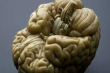اندازه گیری هوش انسان از روی تصاویر مغز