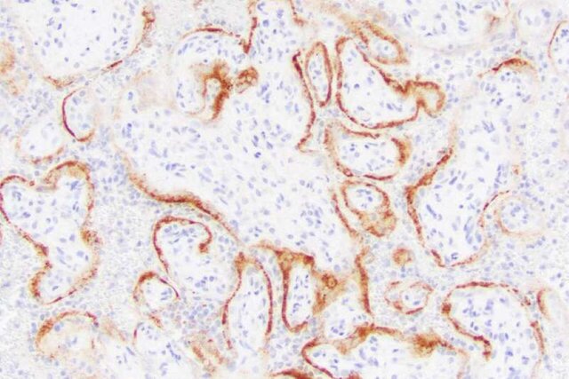 آسیب به جفت عامل مردهزایی در زنان مبتلا به کووید-۱۹ آسیب به جفت عامل مردهزایی در زنان مبتلا به کووید-۱۹