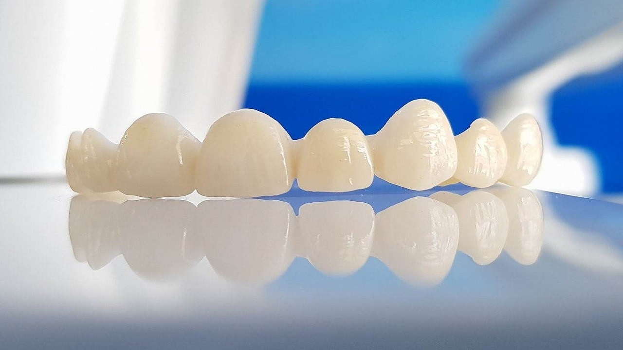 تولید قطعه‌ای کاربردی در دندان برای اولین بار در خاورمیانه
