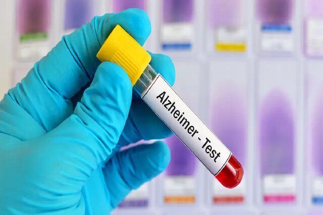 نتایج امیدبخش نوعی آزمایش خون در تشخیص آلزایمر