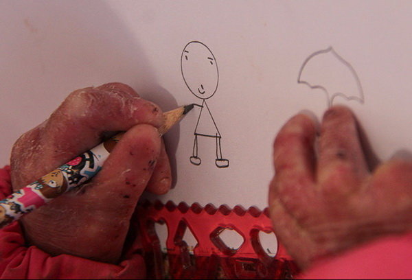 بیمه بیماران نادر؛ همچنان بلاتکلیف / وزارت رفاه فکری کند