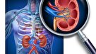 نفرکتومی چیست و چه عوارضو خطراتی دارد؟