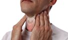 بیماری تیروئید هاشیموتو چیست و چگونه تشخیص داده می شود؟