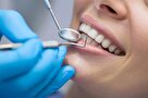 دلایل مهم برای اهمیت بیشتر به سلامت دهان و دندان