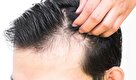 چه مواردی سلامت موهای شما را مختل می کند؟