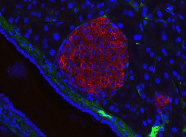 بازسازی سلول‌های بتا پانکراس و درمان دیابت