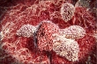 پروتئینی که ۱۰ هزار برابر بیشتر سلول‌های ضد سرطان تولید می‌کند