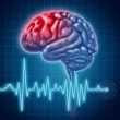 اقدامات اورژانسی هنگام سکته مغزی چیست؟