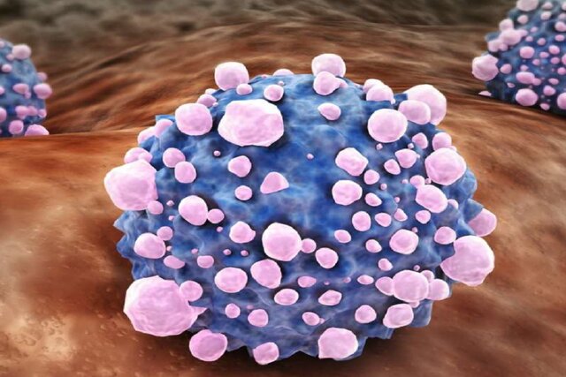 عاملی که به متاستاز سرطان پانکراس منجر می‌شود کشف شد
