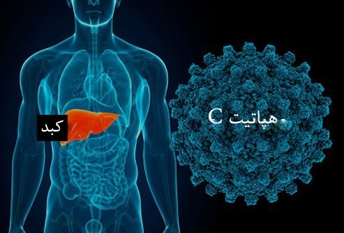 هپاتیت C چیست و و شایع ترین عامل آن در ایران کدام است؟